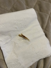 Tissue loss 29 weeks pregnant