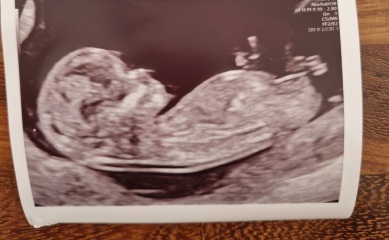 Boy or girl??