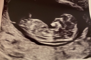 Boy or girl guesses please