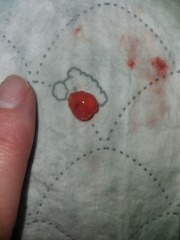 TMI Pics .. miscarriage?