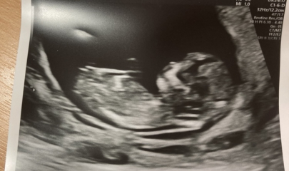 Boy or girl??