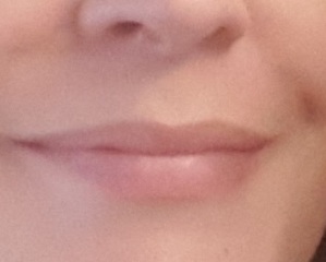 What is with lip fillers?!? They look so fake and awful