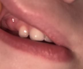 Intermittent temperature