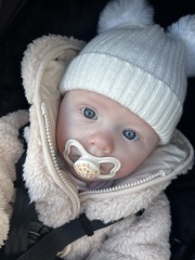 Eye colour change after 6 months? Eyes look multicoloured.