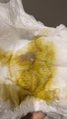 Diarrhoea for 14 days! (*TRIGGER: IMAGE ATTACHED)