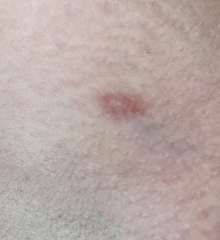 What is this red patch?