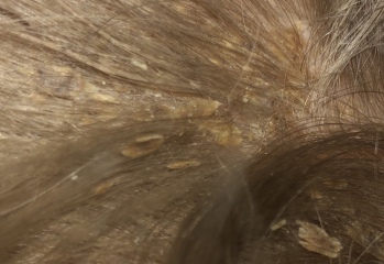 To ask what this could be on my DD scalp and hair?