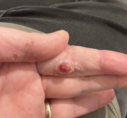 What is this lump?