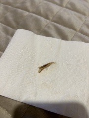 Tissue loss 29 weeks pregnant