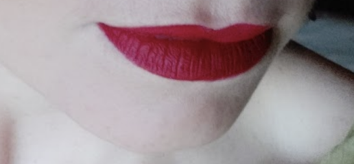 What is with lip fillers?!? They look so fake and awful