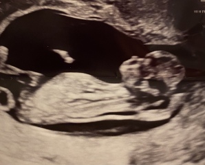 Boy or girl guesses please