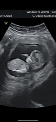 Gender guesses?