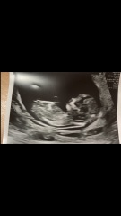 Gender reveal Saturday... final guesses...