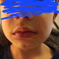 What is this on DS' face?! Photo included.