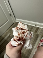 Implantation bleeding?