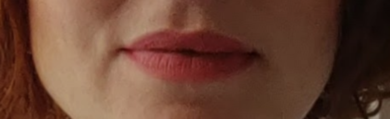 What is with lip fillers?!? They look so fake and awful