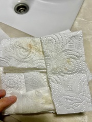 Weird Discharge at 21 weeks HELP