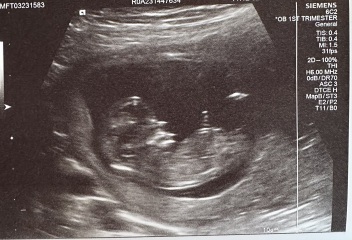 Any nub guesses? Just for fun! x
