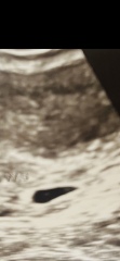 Early scan 2dots