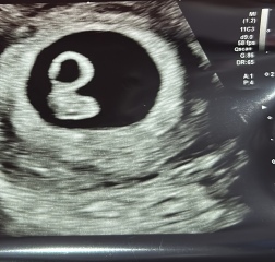 When to book private ultrasound