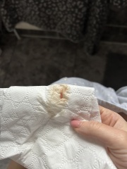 Bleeding 6-7 weeks