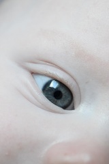 Eye colour change after 6 months? Eyes look multicoloured.