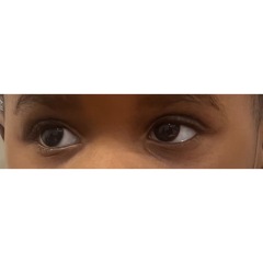 Still Worried about daughter, 20 months pp