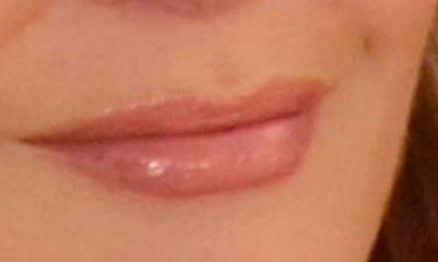 What is with lip fillers?!? They look so fake and awful