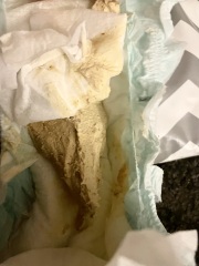 White/pale yellow poo-picture warning