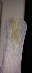 My waters or lots of discharge?