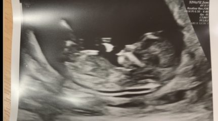 Boy or girl??