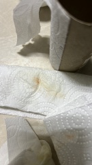 Weird Discharge at 21 weeks HELP