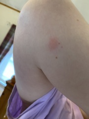 Bed bugs or something else? Pic