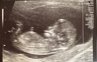 Any nub guesses? Just for fun! x