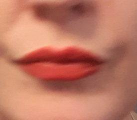 What is with lip fillers?!? They look so fake and awful