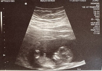 Any nub guesses? Just for fun! x