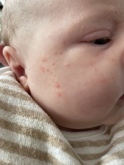 Are these milk spots?!