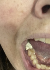 Dentist question with photo!