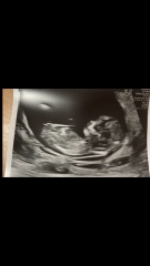 17 hours till we find out! Boy or girl!?