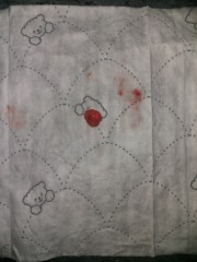 TMI Pics .. miscarriage?