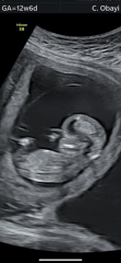 Gender guesses?