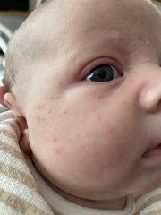 Are these milk spots?!