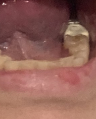 Dentist question with photo!
