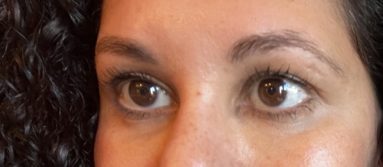 Does ANYTHING help with dark circles and hollow under eyes? 😩