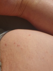 What are these lumps?