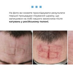 Ukraine Invasion: Part 46