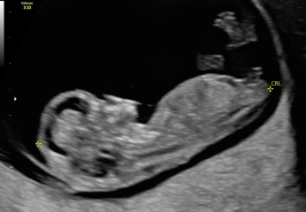 Nub theory - confused by scan