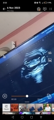 Gender