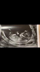 17 hours till we find out! Boy or girl!?