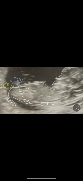 Anyone good at guessing the nub theory?